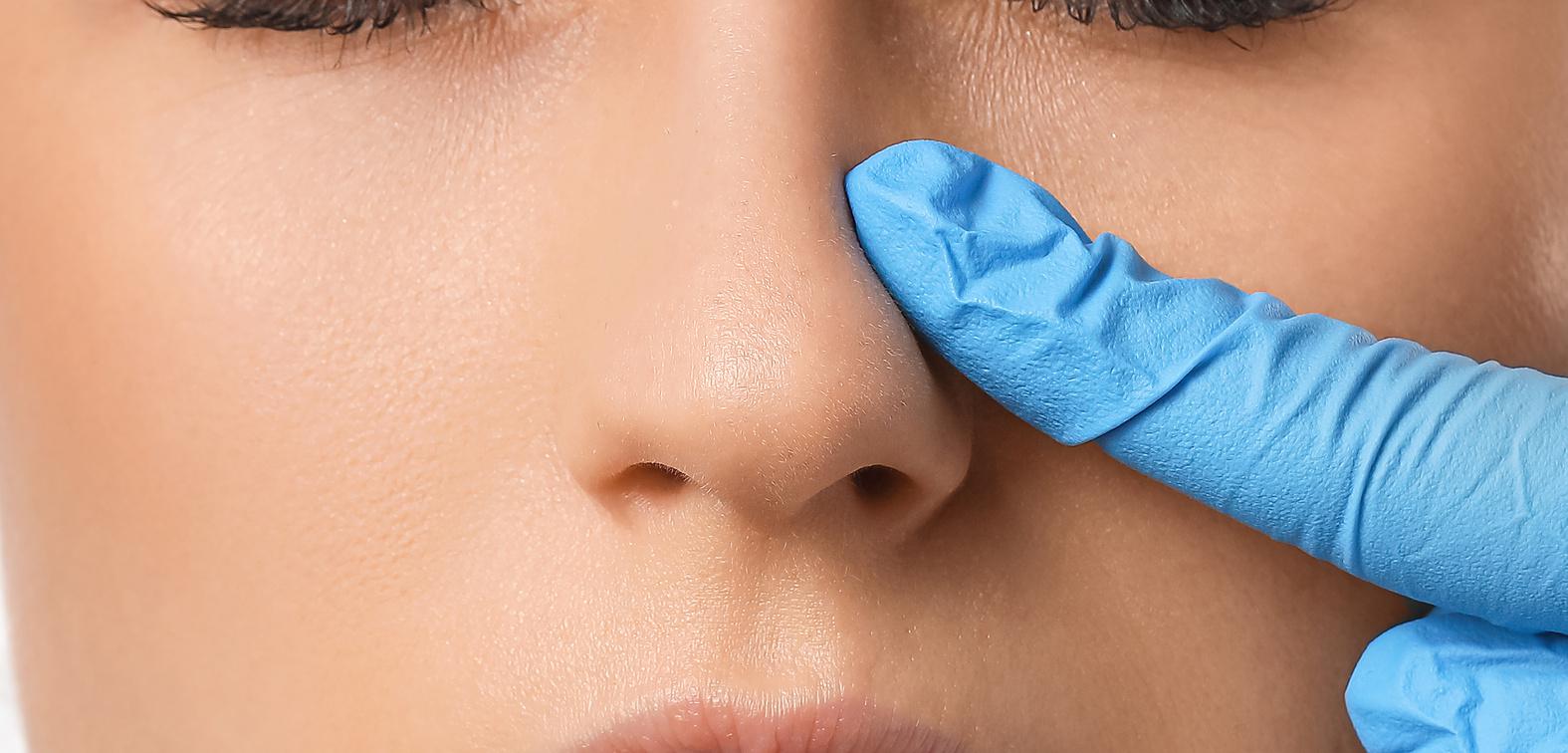 Functional Rhinoplasty