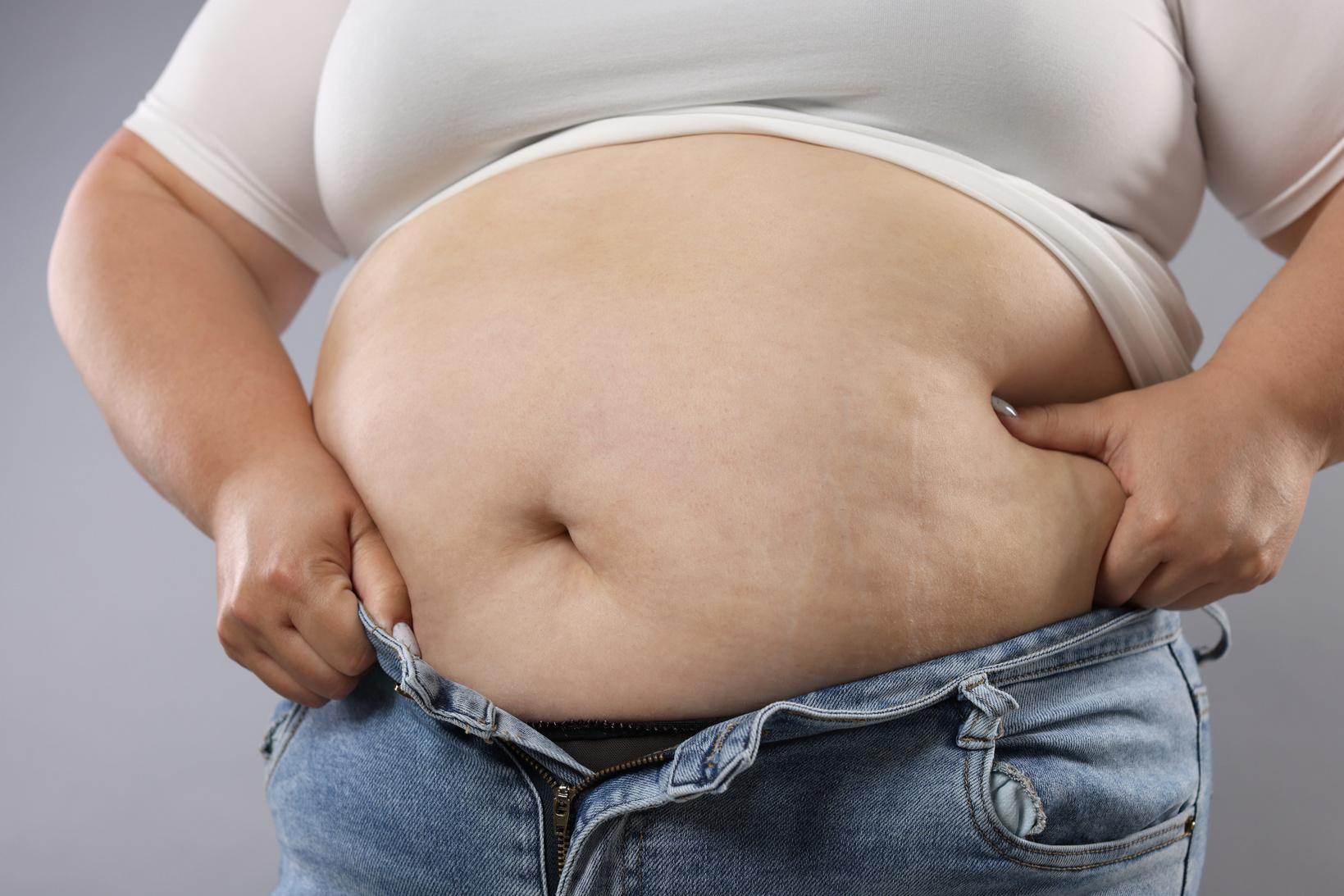 Gastric Sleeve Surgery